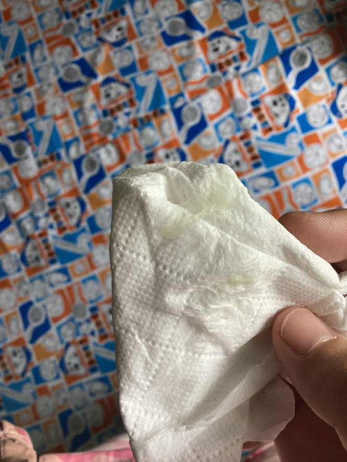 ตกขาวรึมูก37+1