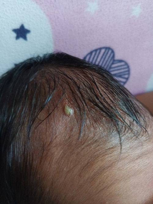 Ano po tong nasa ulo ni baby?