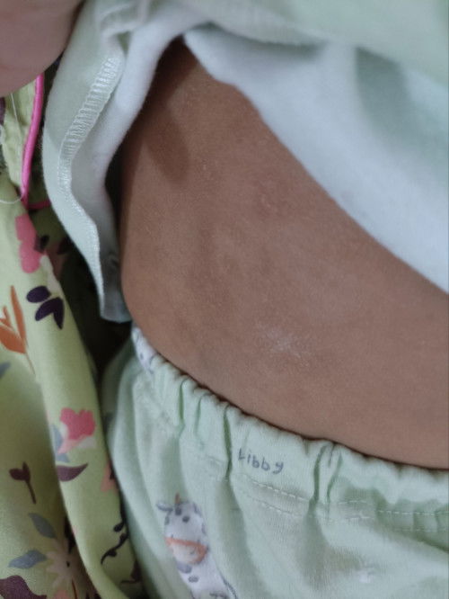 harus dikasi apa ya bund