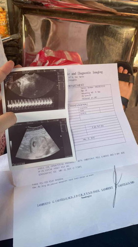 8weeks pregnant