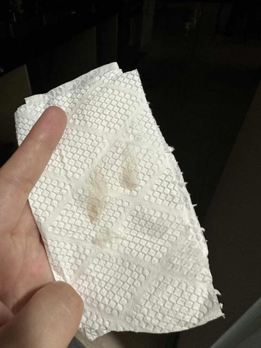 Brown discharge?