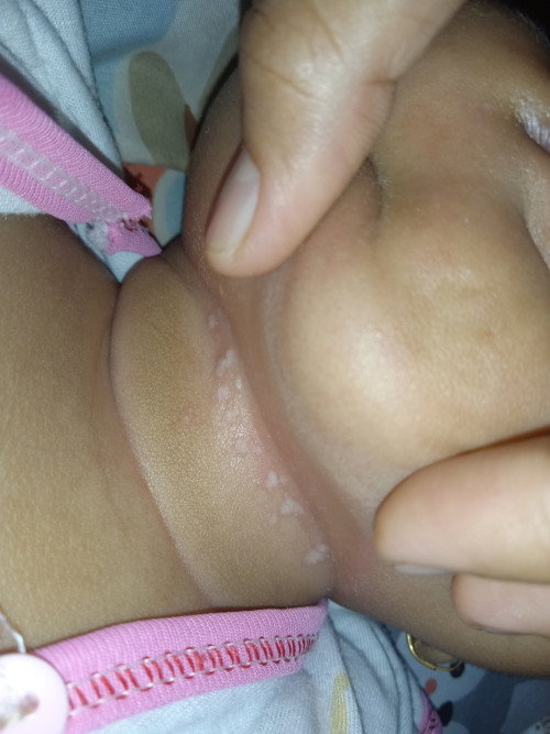Kesehatan bayi