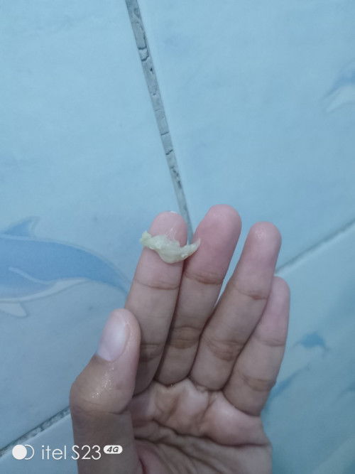 Antara keputihan dan ingin hamil