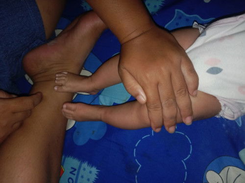 สอบถามค่ะแบบนี้เรียกขาโก่งไม่ค่ะ