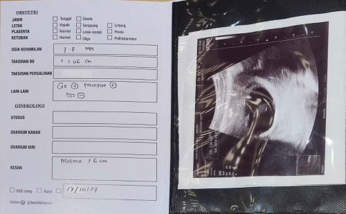 janin tidak berkembang