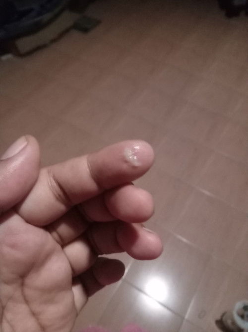 เป็นตกขาวไม่มีกลิ่นตอน23สัปดาห์1วัน