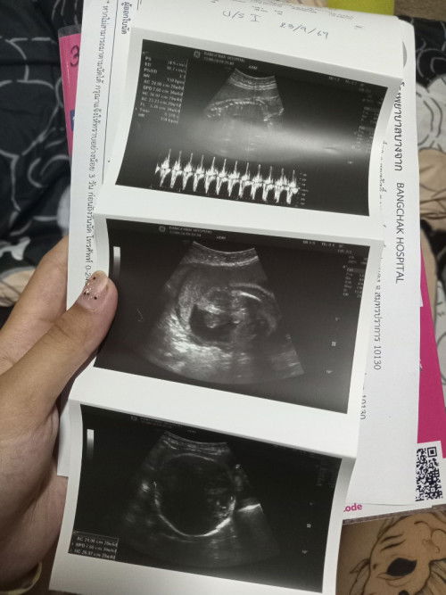 แม่ๆคิดว่าน้องเป็นผญ.หรือผช.คะ