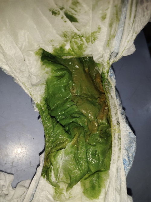 Poops na color green