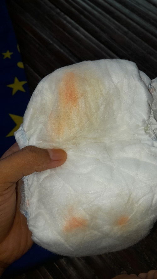 Bun ada ngga sih yang seperti ini juga,aku khawatir bgt sama baby ku soal y udah 3kli,babyku kaya gn