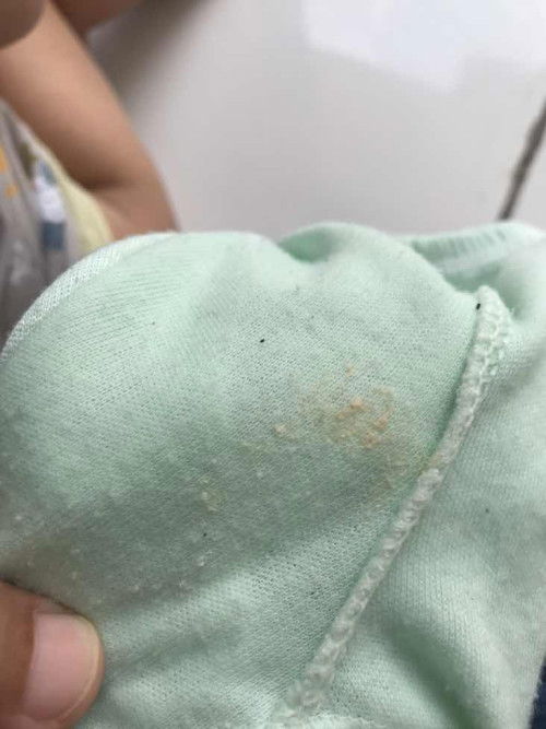 Kencing ada ampas dicelana