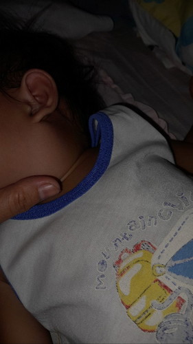 My bukol c baby sa my tinga sinu po my same case dito?