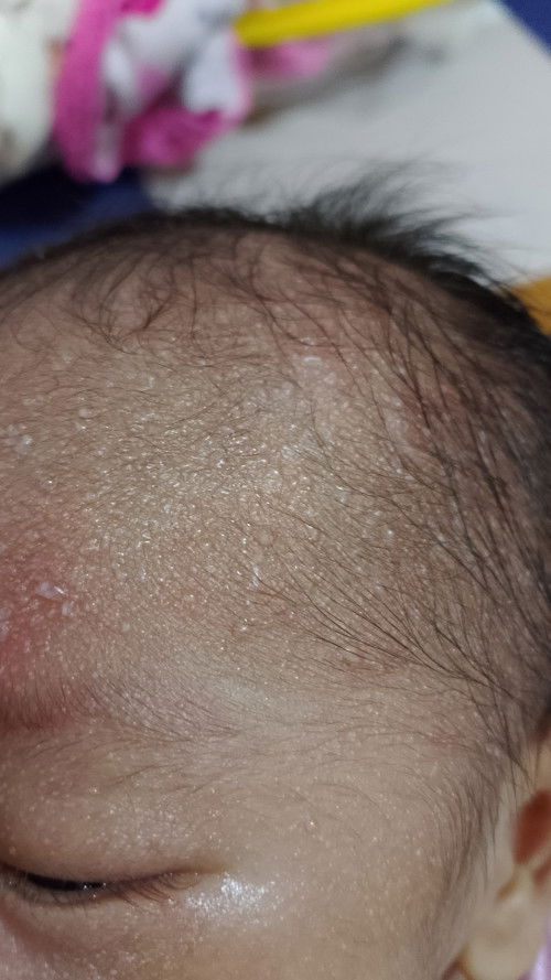 Bintik seperti berair