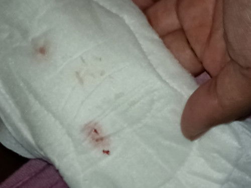 Pernah ngalamin ndak bun?