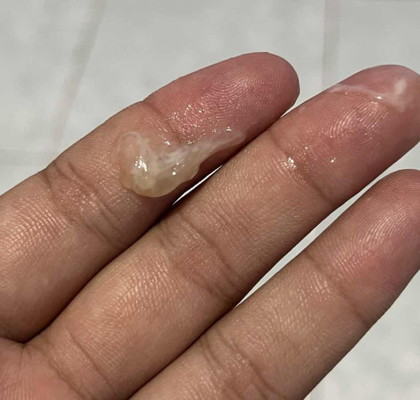 แบบนี้ใช่มูกใสที่เขาว่าไหมค่ะ