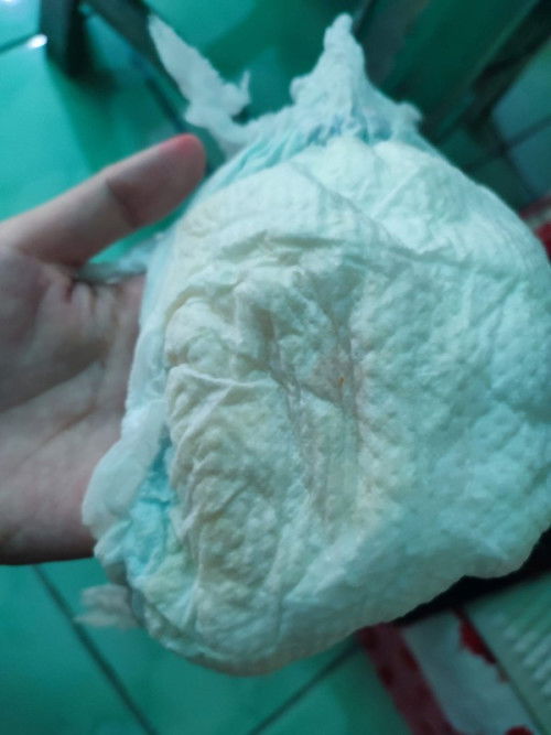 pampers baby 4 bulan ada bercak