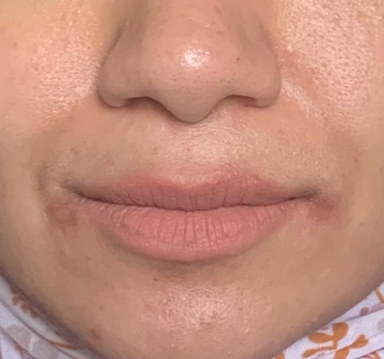 Kulit Muka Kering 🥲