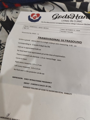Thoughts mga mi?