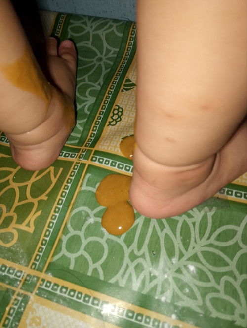 Ganto po ba talaga poop ng nagtatae na 11 months old?
