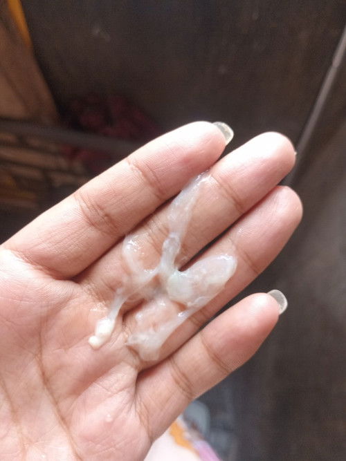 nilalabas po ako ng white mens po ata to diko alam nung 2 to 3months po nilabasan din po ako neto