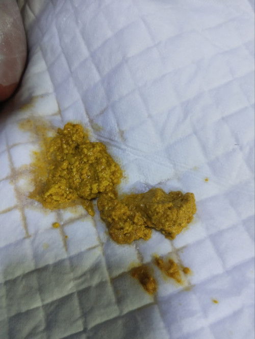 สอบถามแม่ๆหน่อยค่ะ