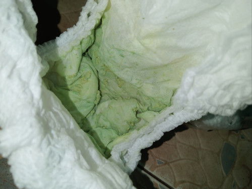 ถ่ายเหลวสีเขียววันละหลายครั้งแต่ไม่มีไข้ร่าเริงดีมีผื่นตามตัวแล้วก็พึงหายจากโรคมือเท้าปากค่ะ