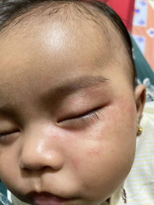 Rumah merah diarea mata