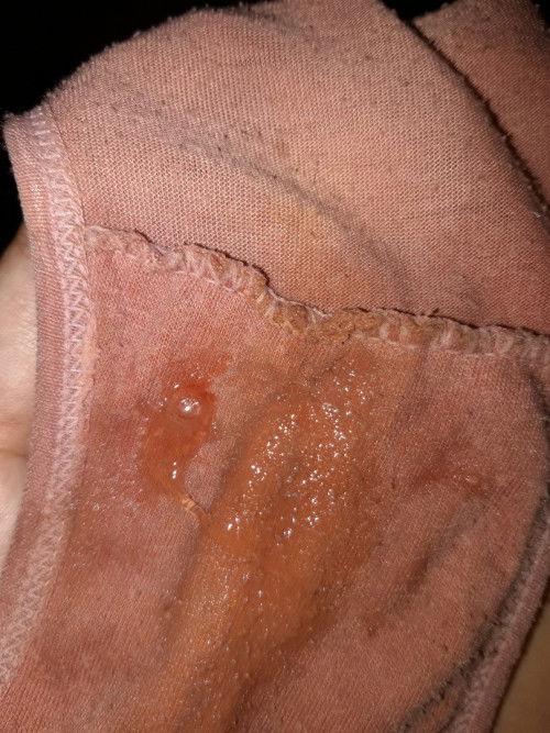 40 wek 6 hari Tapi blom lahiran🥺