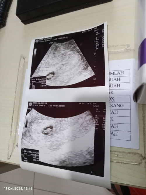 Yang paham arti Gambar detail Usgb