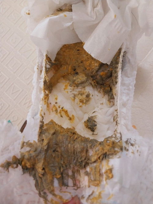 Warna abu abu pada pup bayi apakah normal ?