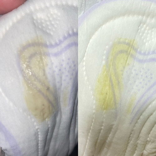 Normal ke keputihan macam
Nie?