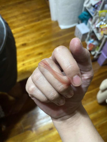 ตรวจภายในแล้วมีมูกเลือด