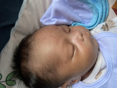 Nagmumuta po ang right eye ni baby, normal lang po ba yun 9 days na po at 2 weeks old palang po siya