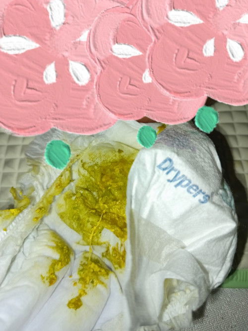 Najis bayi 1 bulan kuning kehijauan