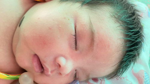 หน้าน้องแพ้อะไรค่ะ