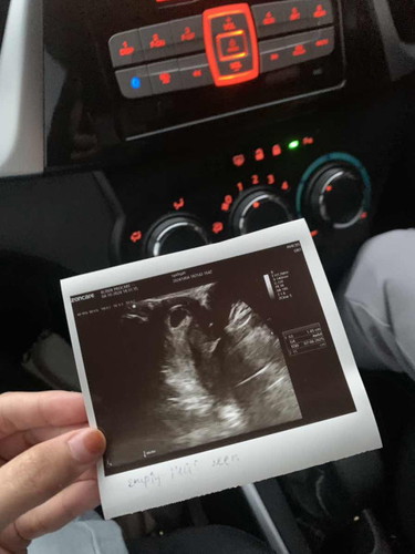 Scan Weeks
