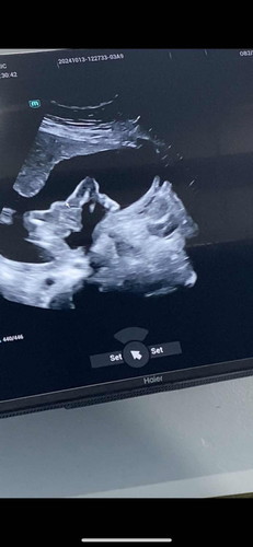 ช่วยดูหน่อยค่ะ น้องเป็นชาย หรือหญิง