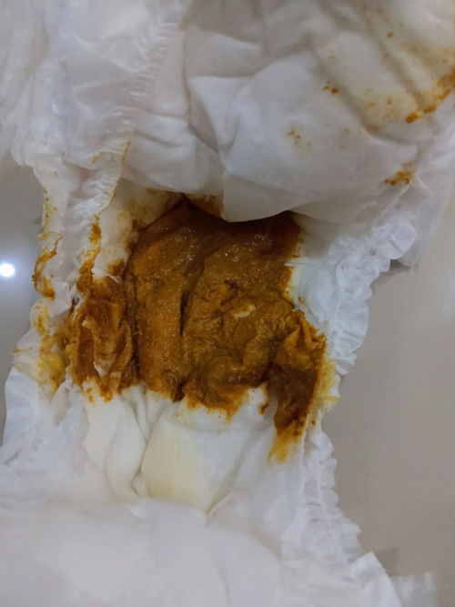 Volume dan tekstur bab bayi 9 bulan