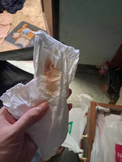 ครรภ์39+1 กำหนดคลอด19ตุลา