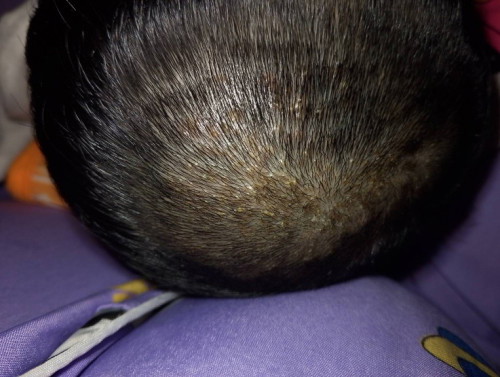 สอบถามแม่ๆหน่อยค่ะ