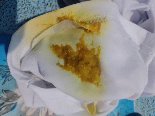 MGA MOMMY ANONG IBIG PONG SABIHIN KAPAG GANITO ANG POPO NI BABY FORMULA FEED PO SYA SALAMAT PO