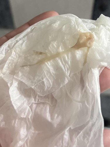 Implantation bleeding?