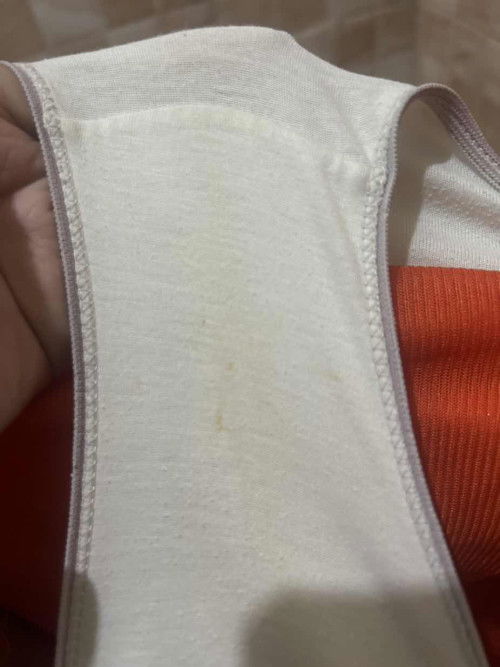 Yellow stain 8 weeks pregnant