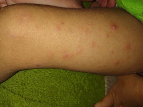 Hello po tanung kulang po kung sinu  Dito nakaranas ng ganito sa baby po ninyu po? Anu kaya ito ??