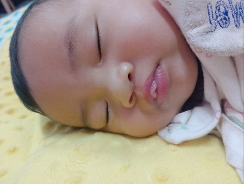 ลูกแม่ๆ เป็นกันบ้างไหมคะ