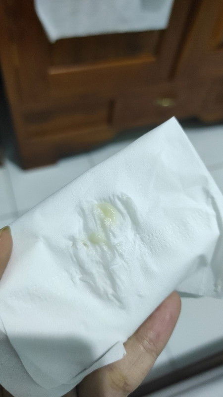 Nyeri pinggang dan keputihan di usia 9w