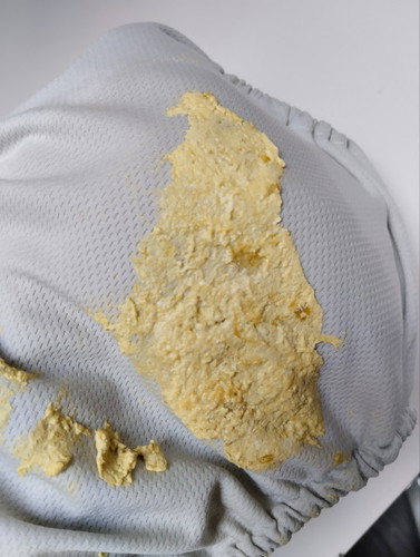 Is this color considered a pale stool?