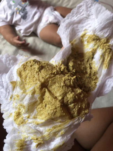 ถ่ายสีแบบนี้ผิดปกติมั้ยคะ