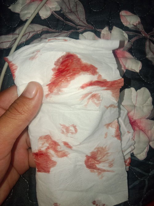 APA PATUT SAYA BUAT ?