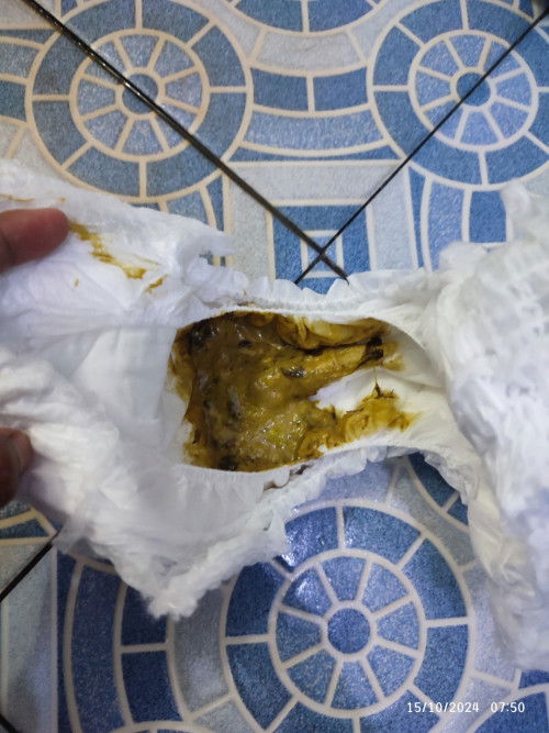 Anak 17 bulan pup 3 - 4x