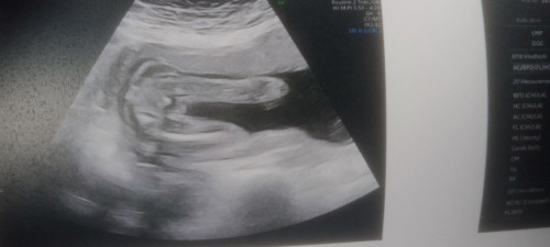 สอบถามคะแม่ว่าผู้หญิงหรือผู้ชายคะคุณหมอบอกน่าจะผู้หญิง